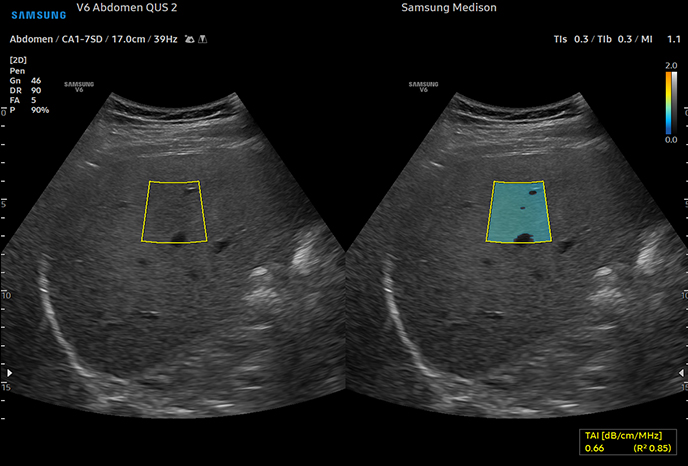 심장 초음파 예시 이미지 08