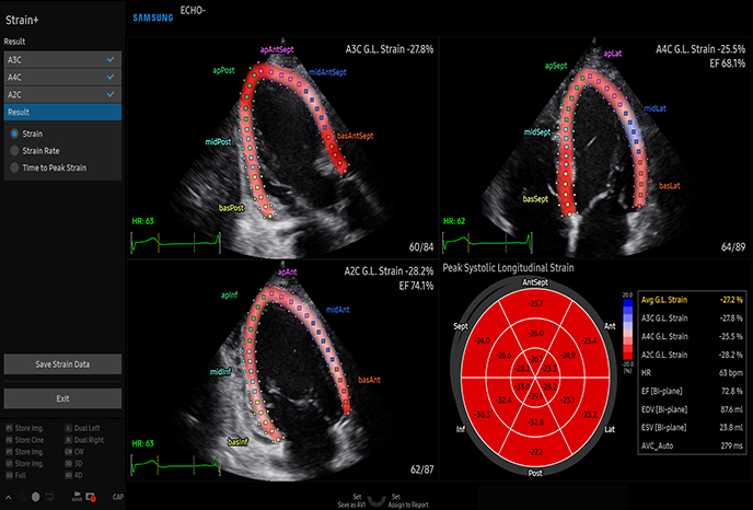 심장 초음파 예시 이미지 12