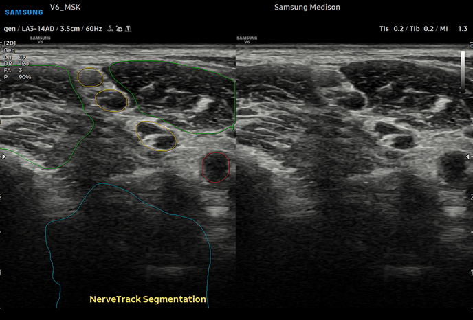 심장 초음파 예시 이미지 17