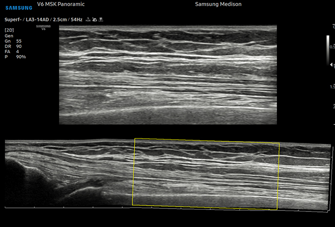 심장 초음파 예시 이미지 18